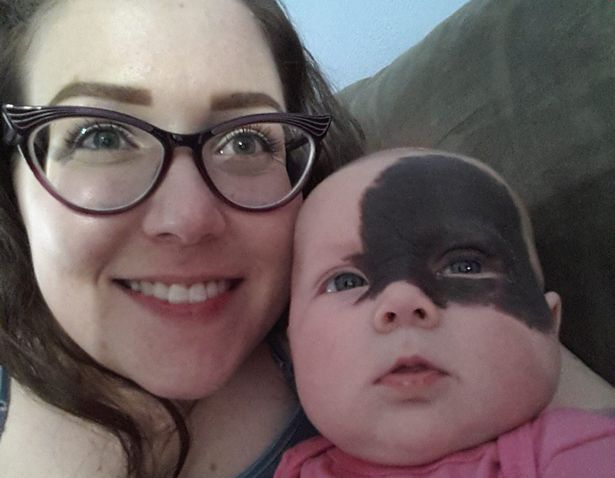 Baby born with a Batman mask (Photo)