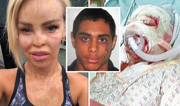 Katie Piper attacker released from life sentence
