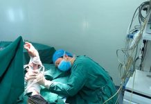 Surgeon falls asleep after 20 hours non-stop to save urgent patients Surgeon falls asleep after 20 hours non-stop to save urgent patients