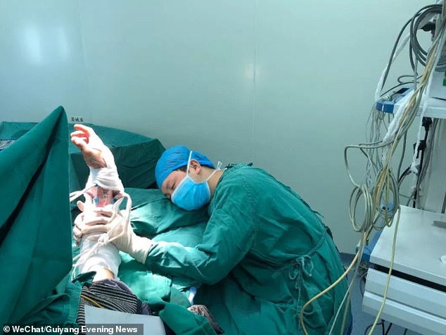 Surgeon falls asleep after 20 hours non-stop to save urgent patients