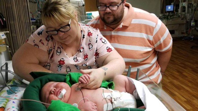This record-breaking baby is stealing hearts in Texas, Report