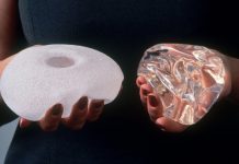 Breast implants linked to rare cancer, Says New Study Breast implants linked to rare cancer, Says New Study