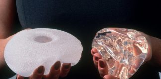Breast implants linked to rare cancer, Says New Study Breast implants linked to rare cancer, Says New Study