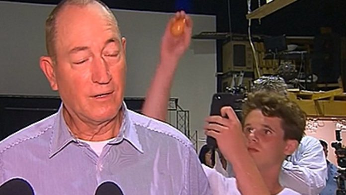 Egg Boy Will Connolly Tells 'The Project' The Egg Has “United People” (Reports)