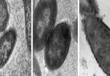 ISS bacteria: Space Station infested with “disease-inducing” ISS bacteria: Space Station infested with “disease-inducing”