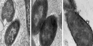 ISS bacteria: Space Station infested with “disease-inducing”