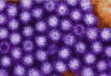 Norovirus outbreak at Louisiana casino (Reports) Norovirus outbreak at Louisiana casino (Reports)
