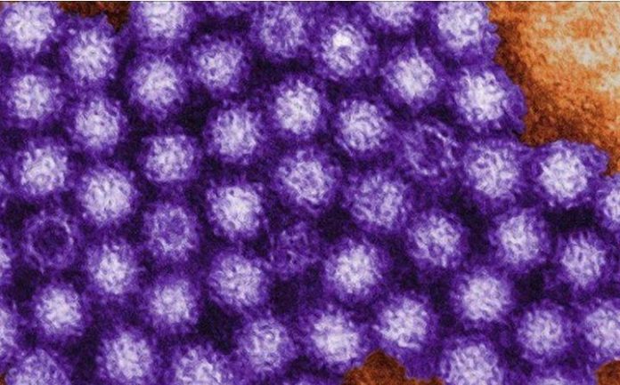 Norovirus outbreak at Louisiana casino (Reports)