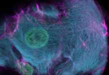 CRISPR-HOT: New genetic tool developed to label specific genes in human CRISPR-HOT: New genetic tool developed to label specific genes in human