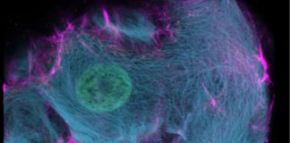 CRISPR-HOT: New genetic tool developed to label specific genes in human