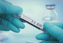 Coronavirus USA Live Updates: 471 deaths across 34 states Coronavirus USA Live Updates: 471 deaths across 34 states