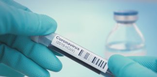 Coronavirus USA Live Updates: 471 deaths across 34 states Coronavirus USA Live Updates: 471 deaths across 34 states