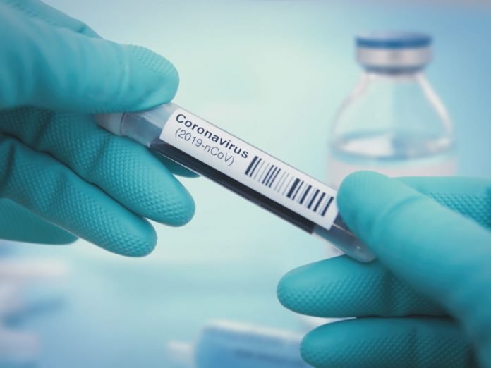 Coronavirus USA Live Updates: 471 deaths across 34 states