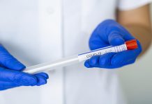 Coronavirus Australia Live News Updates: Victoria’s COVID-19 cases jump by 17 Coronavirus Australia Live News Updates: Victoria's COVID-19 cases jump by 17