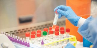 Coronavirus USA Updates: FDA approves first at-home collection kit for COVID-19 Coronavirus USA Updates: FDA approves first at-home collection kit for COVID-19