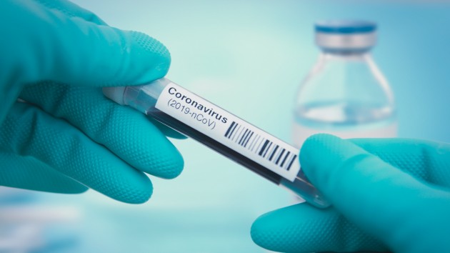 Coronavirus USA Updates: California sheriff says officers won't enforce coronavirus public health orders