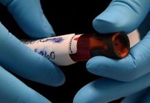 Coronavirus USA Updates: New data shows COVID-19 was in Ohio as early as January Coronavirus USA Updates: New data shows COVID-19 was in Ohio as early as January