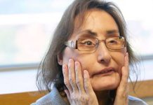 Connie Culp, first US partial face transplant recipient, dies at age 57 Connie Culp, first US partial face transplant recipient, dies at age 57