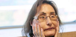 Connie Culp, first US partial face transplant recipient, dies at age 57 Connie Culp, first US partial face transplant recipient, dies at age 57