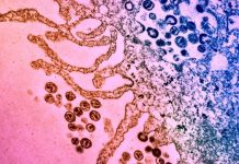 Antibiotic molecule enables immune system to kill HIV infected cells, Researchers Say Antibiotic molecule enables immune system to kill HIV infected cells, Researchers Say