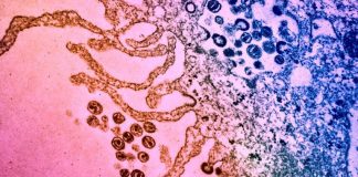 Antibiotic molecule enables immune system to kill HIV infected cells, Researchers Say Antibiotic molecule enables immune system to kill HIV infected cells, Researchers Say