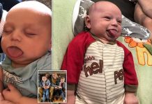Boy, 3, was born with a tongue FOUR times too big for his mouth (Picture) Boy, 3, was born with a tongue FOUR times too big for his mouth (Picture)