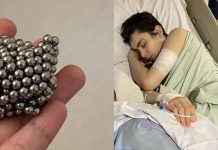 Schoolboy undergoes life-saving operation after swallowing 54 magnets (Photo) Schoolboy undergoes life-saving operation after swallowing 54 MAGNETS (Photo)